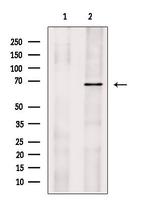 SLC22A4 Polyclonal Antibody
