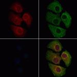 HCN3 Polyclonal Antibody