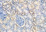 CCL27 Polyclonal Antibody