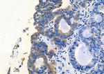 CCL27 Antibody in Immunohistochemistry (Paraffin) (IHC (P))