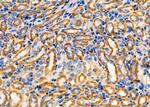 CCL27 Antibody in Immunohistochemistry (Paraffin) (IHC (P))