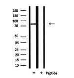 CLASRP Antibody in Western Blot (WB)