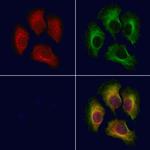 TRAPPC1 Polyclonal Antibody