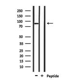 TMC7 Polyclonal Antibody