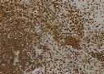 CAPG Polyclonal Antibody