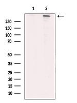 RyR2 Polyclonal Antibody