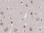 Phospho-AKT1/AKT2/AKT3 (Ser473) Antibody in Immunohistochemistry (Paraffin) (IHC (P))
