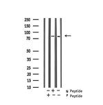 Phospho-Glucocorticoid Receptor (Ser203) Polyclonal Antibody
