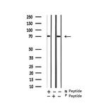 Phospho-RIP2 (Ser176) Antibody in Western Blot (WB)