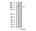 CARD6 Antibody in Western Blot (WB)