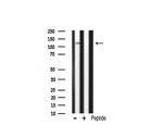 CARD6 Antibody in Western Blot (WB)