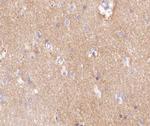 Factor VIII Polyclonal Antibody