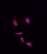 COPS3 Polyclonal Antibody