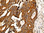 JM4 Polyclonal Antibody