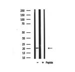 JM4 Antibody in Western Blot (WB)