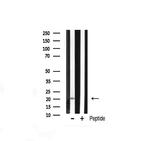 JM4 Antibody in Western Blot (WB)