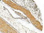 Cytokeratin 10 Antibody in Immunohistochemistry (Paraffin) (IHC (P))