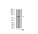 Cytokeratin 10 Antibody in Western Blot (WB)