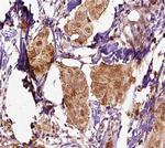Mammaglobin A Polyclonal Antibody
