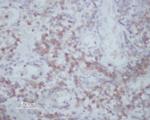 MMP14 Polyclonal Antibody