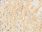 MMP14 Antibody in Immunohistochemistry (Paraffin) (IHC (P))