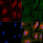 Peripherin Polyclonal Antibody