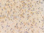 Peripherin Antibody in Immunohistochemistry (Paraffin) (IHC (P))