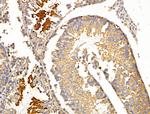Peripherin Antibody in Immunohistochemistry (Paraffin) (IHC (P))