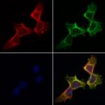 Peripherin Antibody in Immunocytochemistry (ICC/IF)
