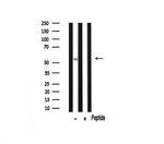 Peripherin Antibody in Western Blot (WB)