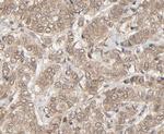 NEDD8 Polyclonal Antibody