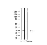 RPL10 Antibody in Western Blot (WB)