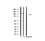 XPF Polyclonal Antibody