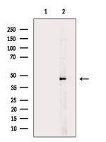 BCKDK Polyclonal Antibody