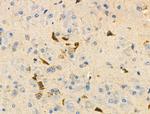 PDZD2 Antibody in Immunohistochemistry (Paraffin) (IHC (P))