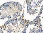 PDZD2 Antibody in Immunohistochemistry (Paraffin) (IHC (P))