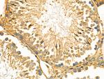 PDZD2 Antibody in Immunohistochemistry (Paraffin) (IHC (P))