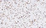 DLX3 Polyclonal Antibody