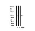 DLX3 Antibody in Western Blot (WB)