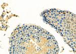 REV3L Antibody in Immunohistochemistry (Paraffin) (IHC (P))