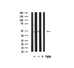 TADA2L Polyclonal Antibody