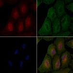 KIP2 Polyclonal Antibody