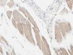 NDUFC2 Polyclonal Antibody