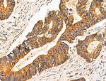 TRIM16 Polyclonal Antibody