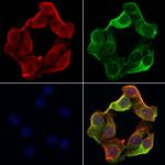 TAP Polyclonal Antibody