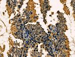 TAP Antibody in Immunohistochemistry (Paraffin) (IHC (P))
