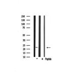RPS9 Antibody in Western Blot (WB)