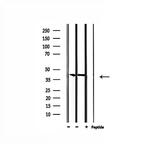 CBX6 Antibody in Western Blot (WB)