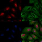 ATRX Polyclonal Antibody