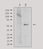 TIN2 Polyclonal Antibody